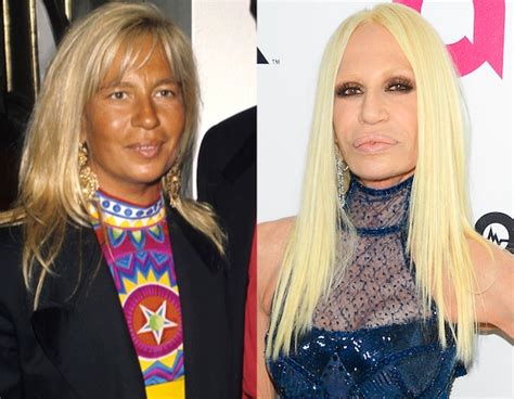 top versace donna|what happened to donatella versace's face.